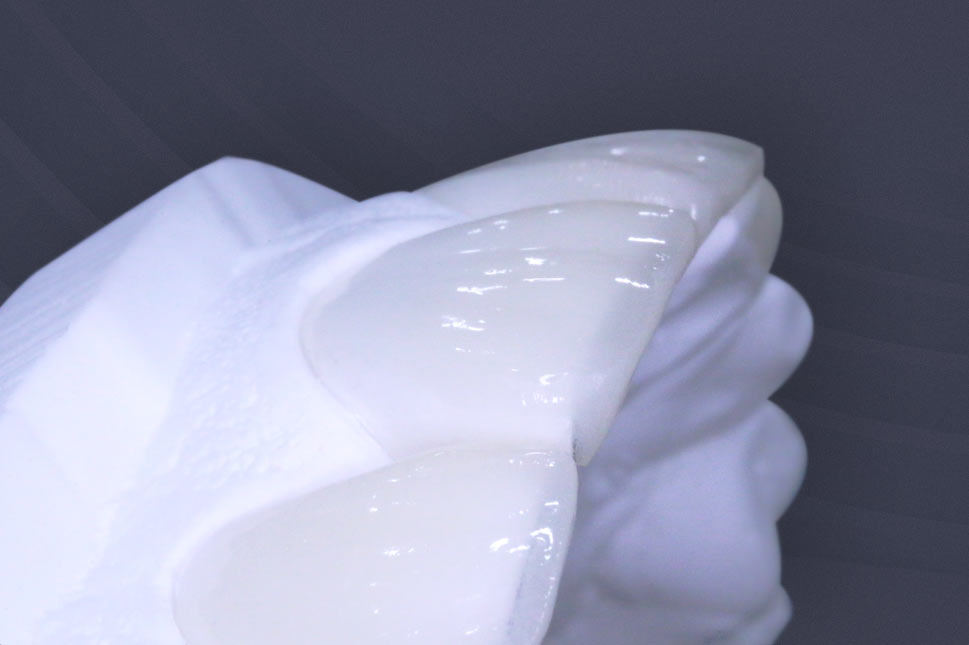 자연스러운 치아 구현 이미지2