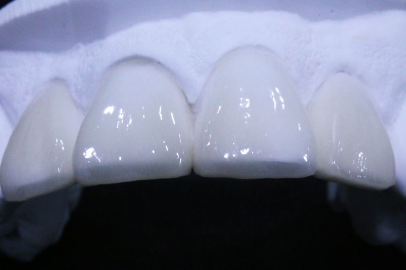 일루미네이트13