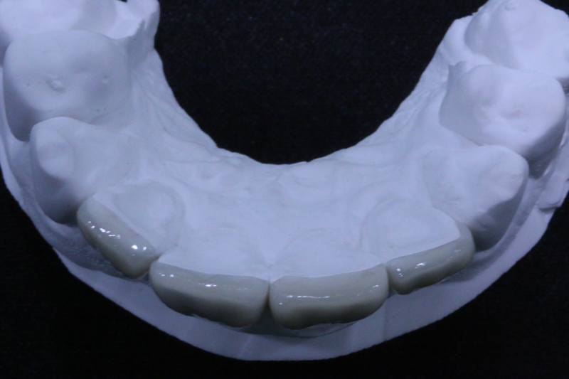 일루미네이트14